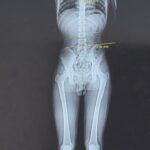 세종 보람동 앤써필라테스, 문진/평가/분석 기반의 메디컬 필라테스 시스템 운영